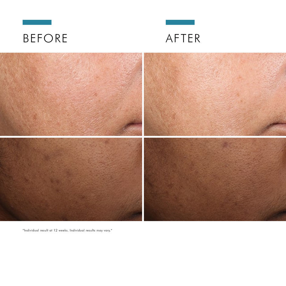 Discoloration Defense Serum 30ml