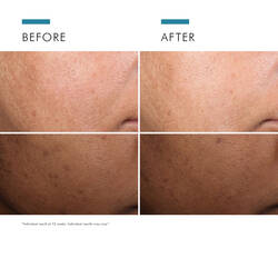 Discoloration Defense Serum 30ml