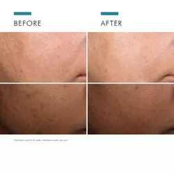 Discoloration Defense Serum 30ml