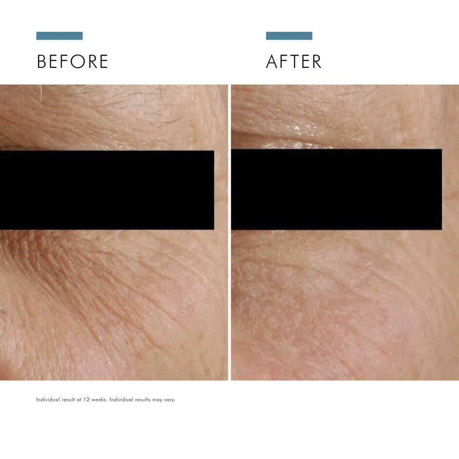 A.G.E. Eye Complex for Ageing Skin 15ml
