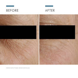 A.G.E. Eye Complex for Ageing Skin 15ml