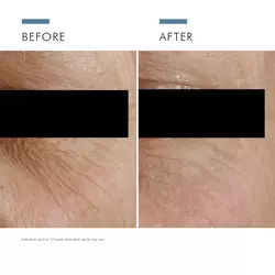A.G.E. Eye Complex for Ageing Skin 15ml