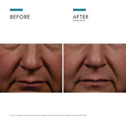 Phloretin CF Vitamin C Antioxidant Serum