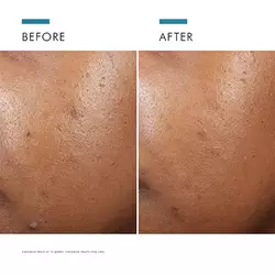 Phyto A+ Brightening Treatment 3% Azelaic Acid