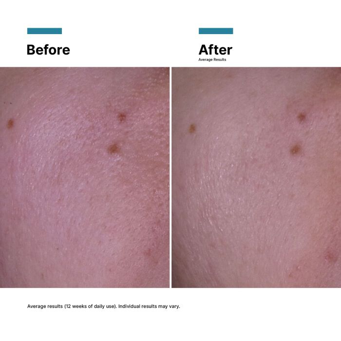 P-TIOX Anti – Wrinkle Cream