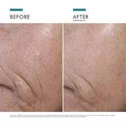 Expert Routine For Signs of Ageing