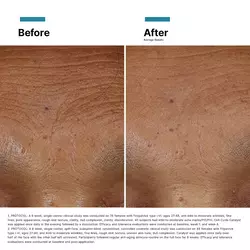 Hydrating & Anti-Ageing Power Pair