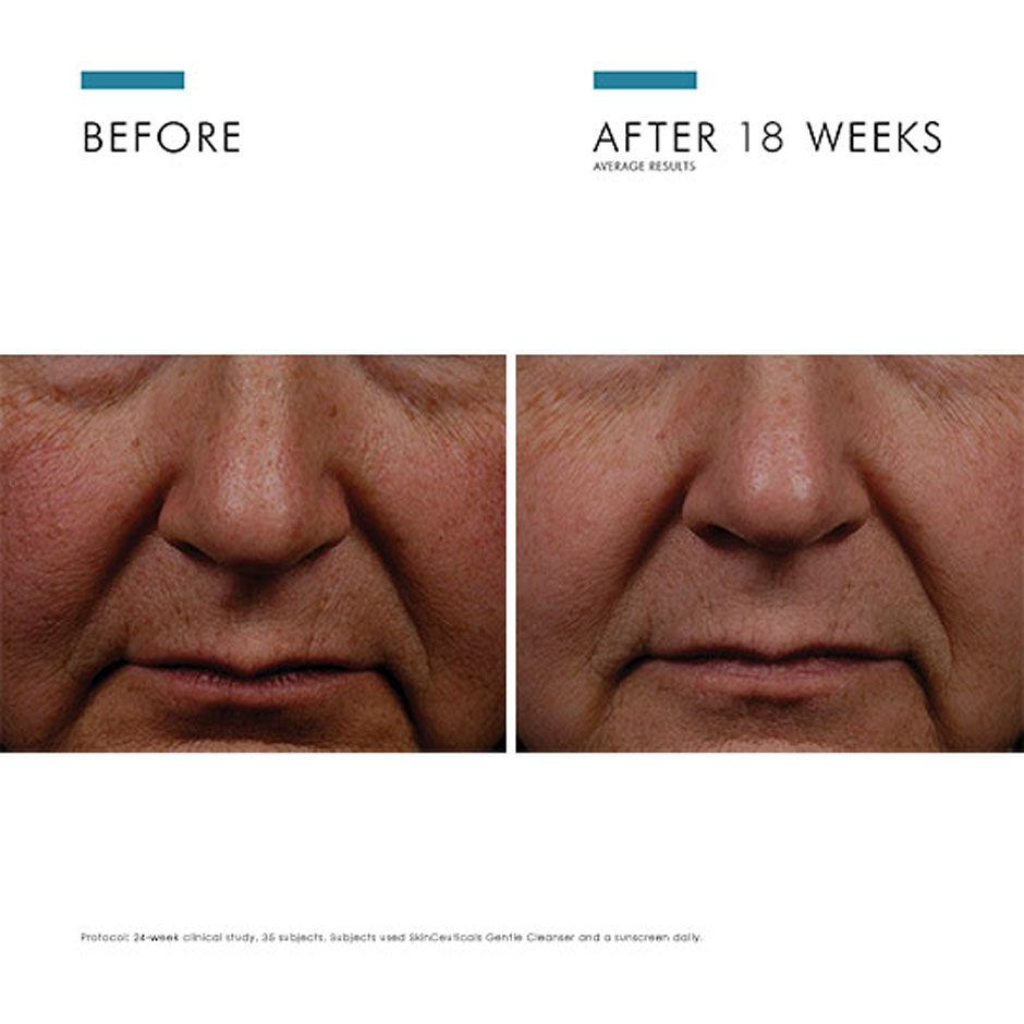 Expert Routine For Dark Spots And Hyperpigmentation