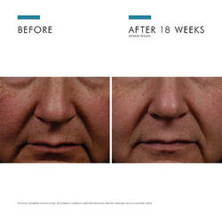 Expert Routine For Dark Spots And Hyperpigmentation