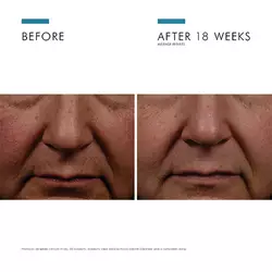 Expert Routine For Dark Spots And Hyperpigmentation