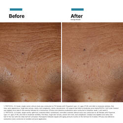 Hyaluronic Acid Intensifier Multi-Glycan