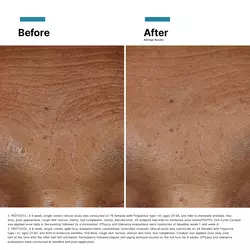 Hyaluronic Acid Intensifier Multi-Glycan