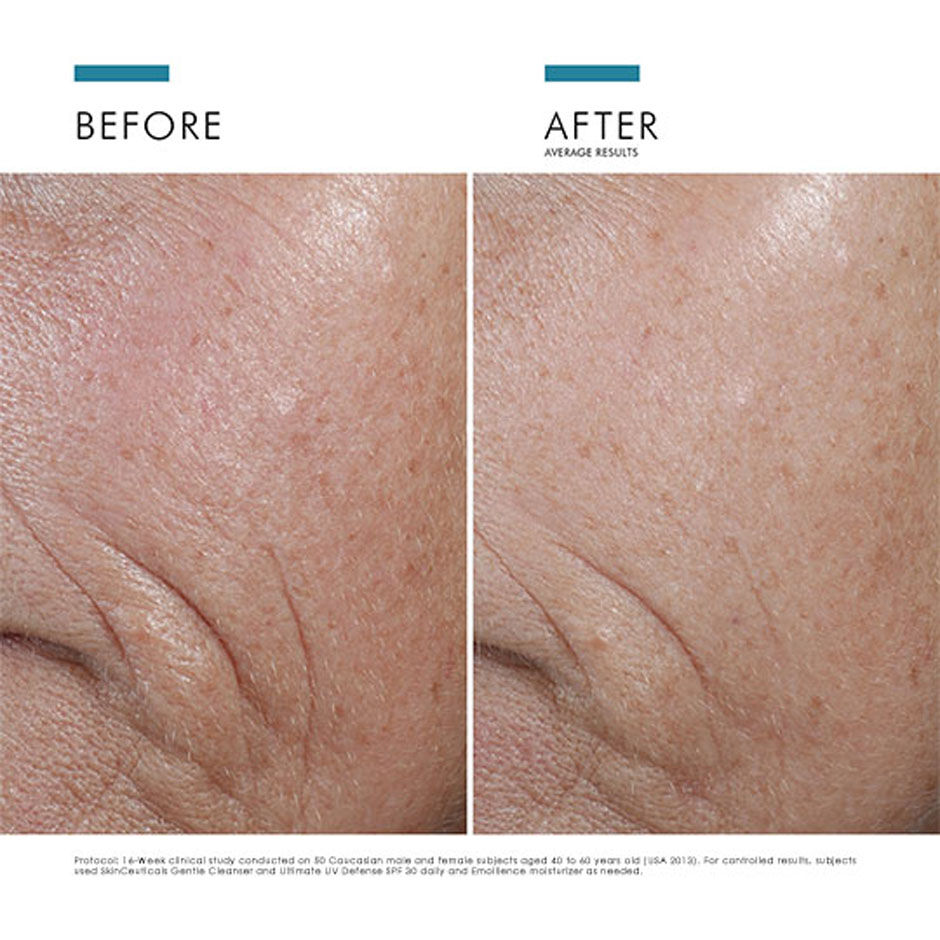 Expert Routine for Dehydrated Skin