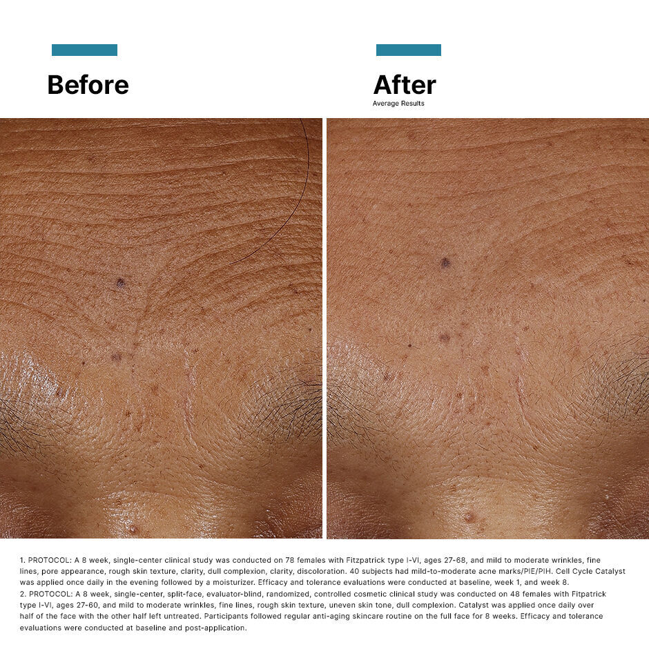 Plumping & Anti-Ageing Power Pair