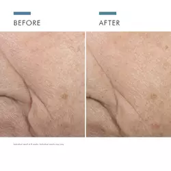Triple Lipid Restore 2:4:2 Cream