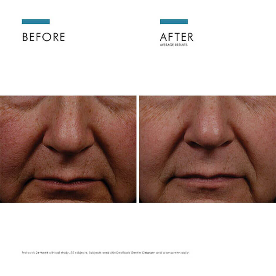 Discolouration Power Pair