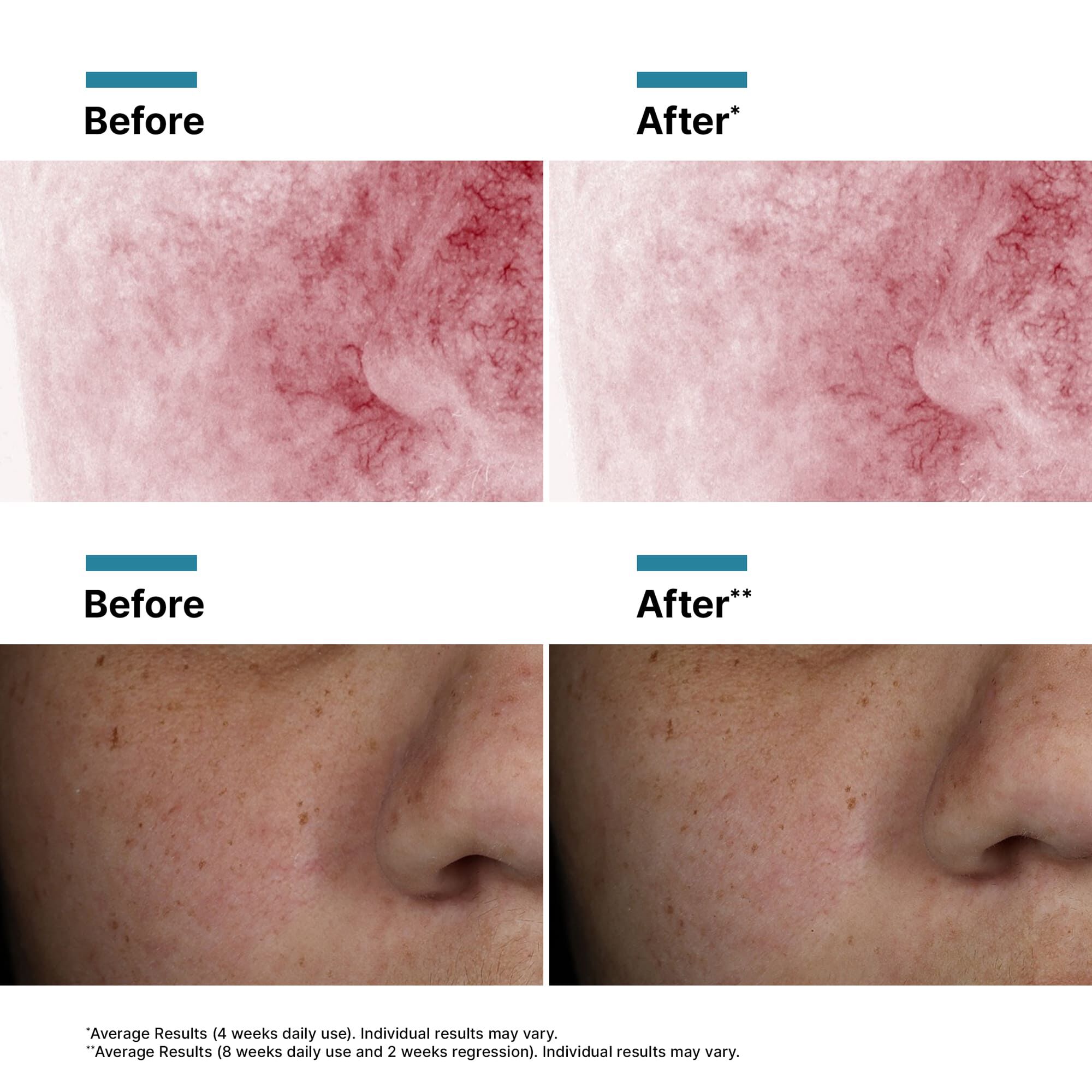Phyto Corrective PDRN Serum