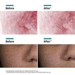Phyto Corrective PDRN Serum