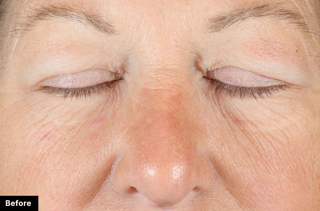 Before Banner