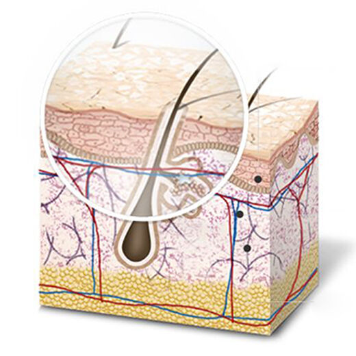 Illustration of skin cross-section, showing layers including the epidermis, dermis, and subcutaneous tissue, with an enlarged view highlighting a hair follicle.