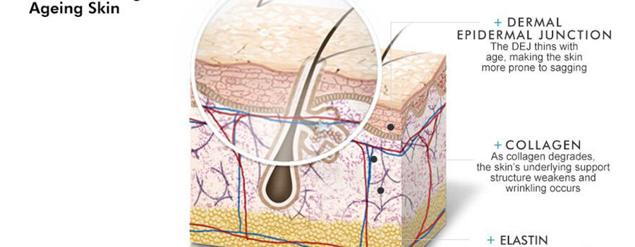 Illustration of skin structure highlighting the dermal-epidermal junction, collagen, and elastin in ageing skin.