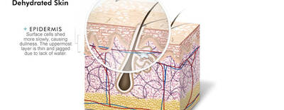 Illustration depicting dehydrated skin, highlighting the epidermis with a magnified view showing thinner, jagged surface layers and slower cell shedding, indicating dullness due to lack of water.