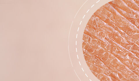 Close-up of textured skin with a soft, natural background.
