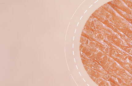 Close-up of textured skin with a soft, natural background.