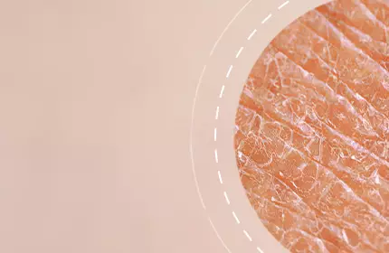 Close-up of textured skin with a soft, natural background.