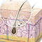 blemishes