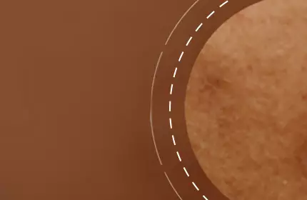 Close-up of textured skin showing small imperfections against a soft, blurred brown background.
