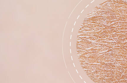 Close-up of textured skin with a light background, highlighting fine lines and natural imperfections.