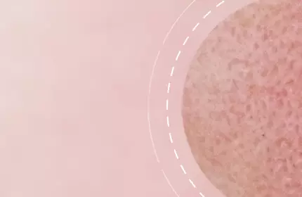 Close-up of a textured round surface against a soft pink background, with a subtle circular design element.