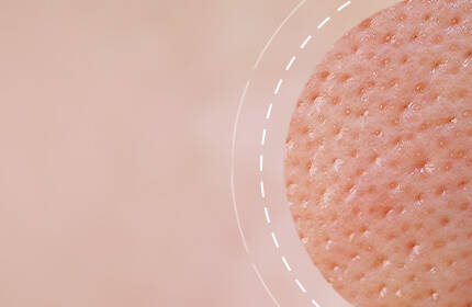 Close-up of textured skin showing fine pores and a smooth, light-toned surface.