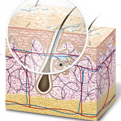 combination skin