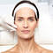 A Definitive Guide To Dermal Fillers