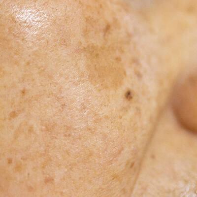 Close up of the ingredient ascorbic acid - iridescent and textured