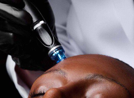 How Antioxidant Serum Works