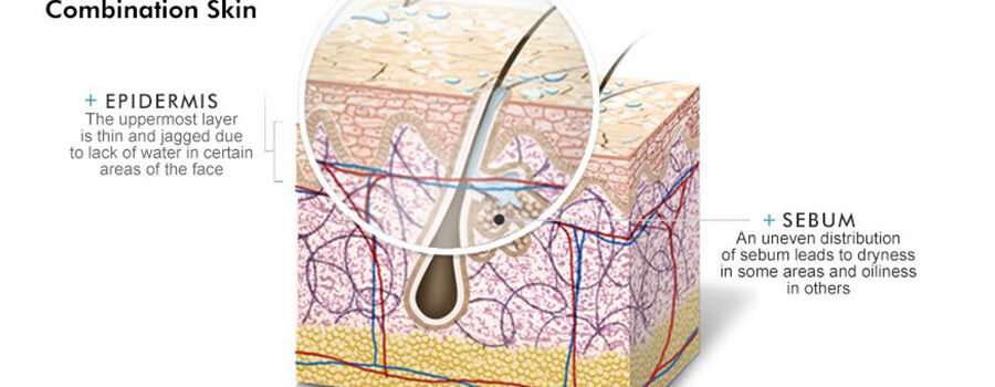 combination-skin