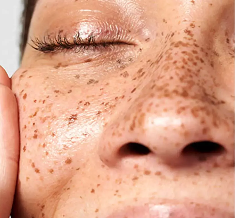 Environmental Aggressors Skin Protection