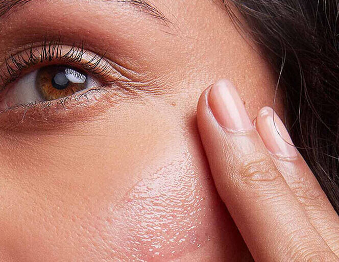 Common laser treatment side effects including facial redness and swelling during the skin’s natural recovery process.