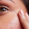 A Definitive Guide To Dermal Fillers
