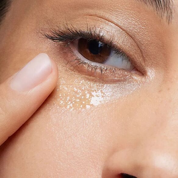 Close-up of smooth under-eye skin with wrinkle-targeting skincare treatment