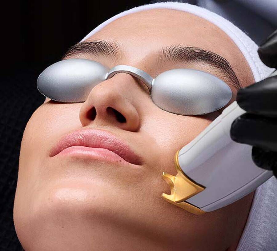 Dermatologist performing facial laser treatment to stimulate collagen production and improve skin tone and texture.