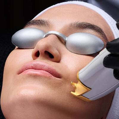 Dermatologist performing facial laser treatment to stimulate collagen production and improve skin tone and texture.