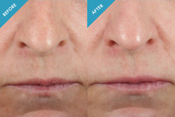 Skinceuticals