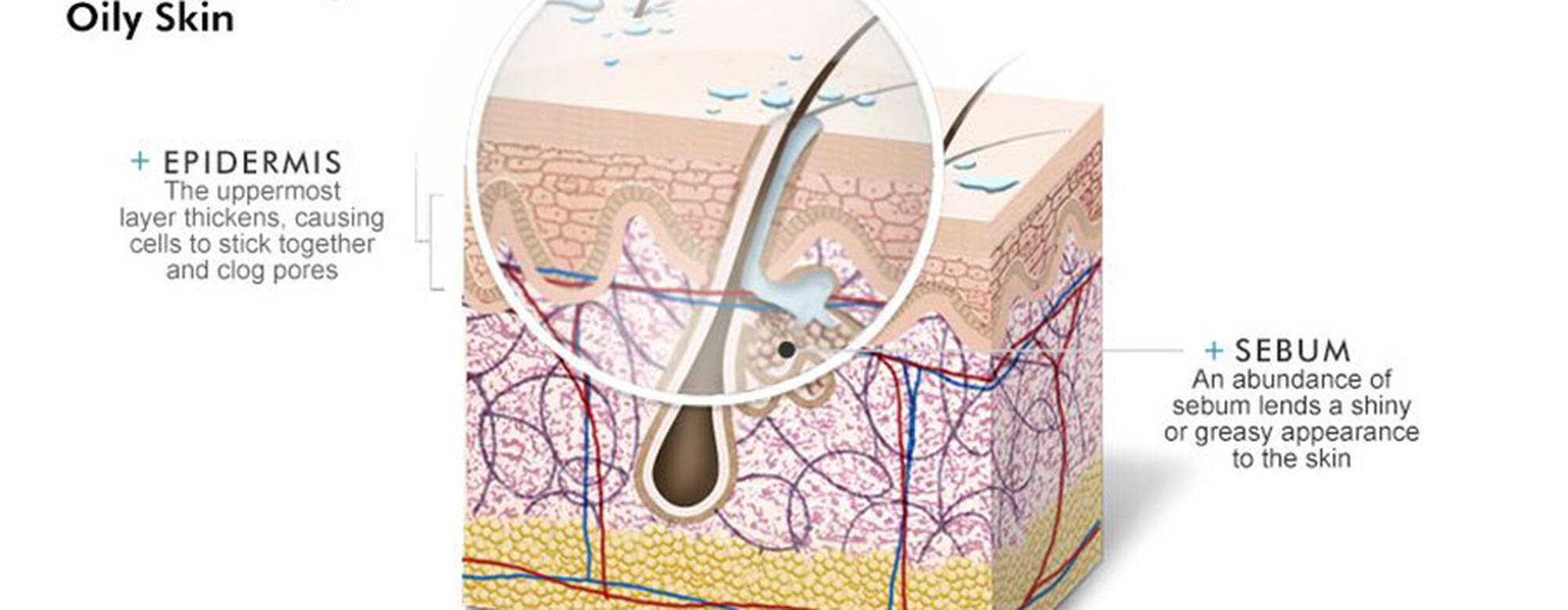 UNDERSTANDING OILY SKIN